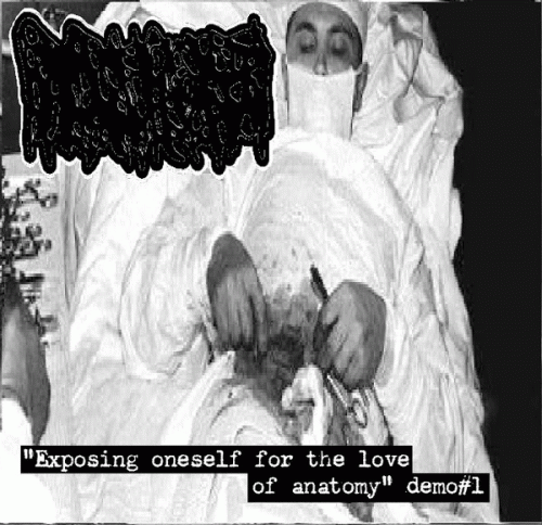 Hydrocephalus : Exposing Oneself for the Love of Anatomy.... Demo No. 1